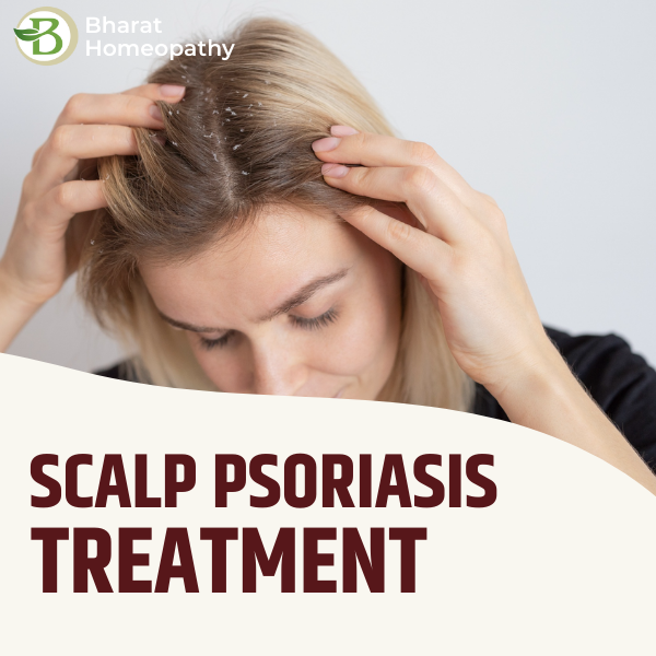 Natural Scalp Psoriasis Treatment